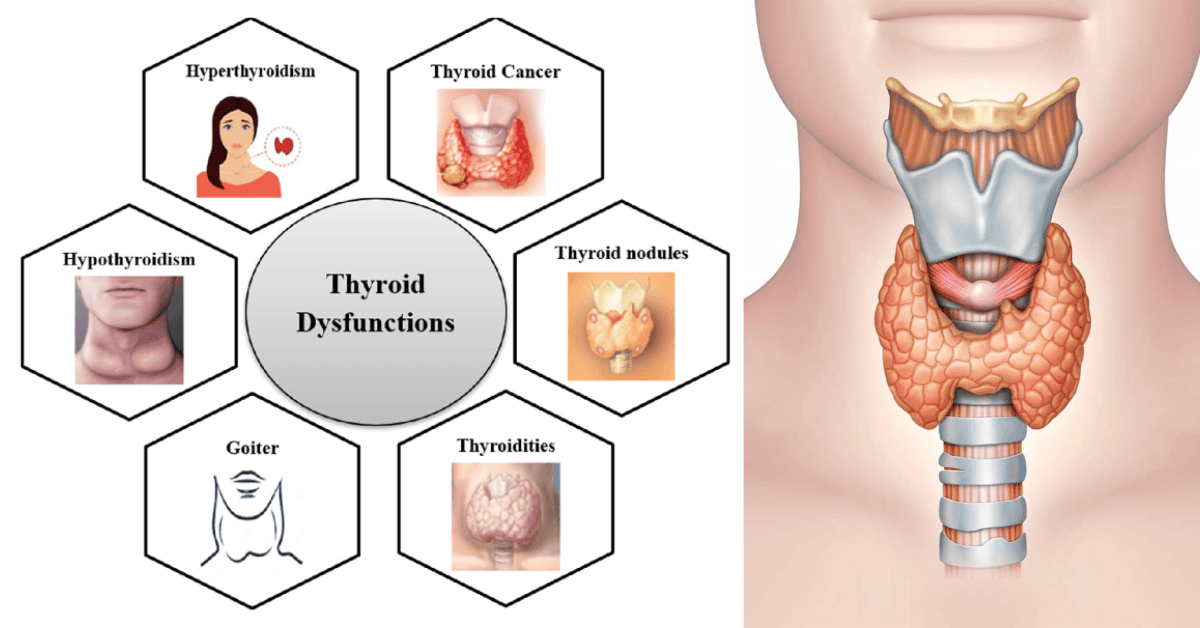 Thyroid